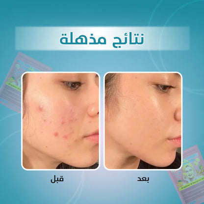 ضمادات التنظيف: الكركم وحمض الكوجيك