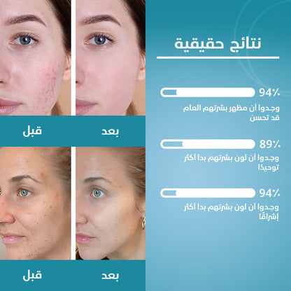 ضمادات التنظيف: الكركم وحمض الكوجيك